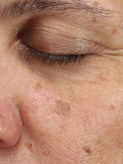 Close up of face before using product